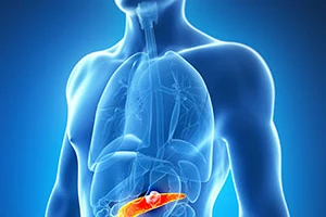 Pancreatic Cancer